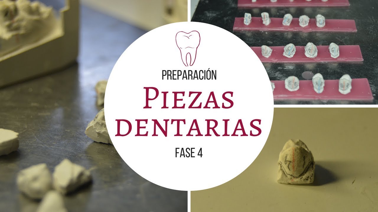 MONTAJE DIAGNSTICO 4/5    FASE 4: Preparacin de piezas dentarias para montaje diagnstico.